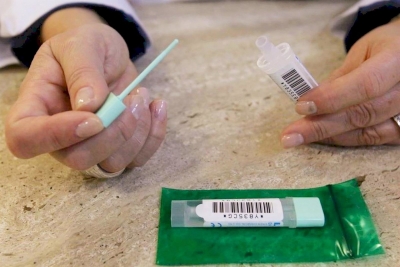  CCOO denuncia falta de transparencia sobre los cribados de cáncer de colon 